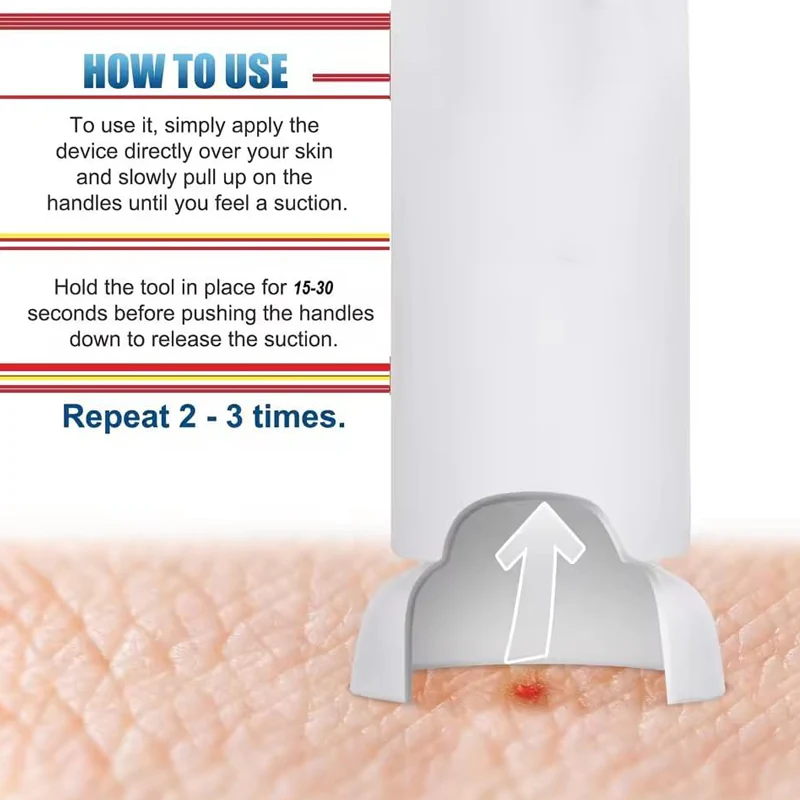 Bite Relief Suction Tool for Mosquito & Bee Stings - Image 5