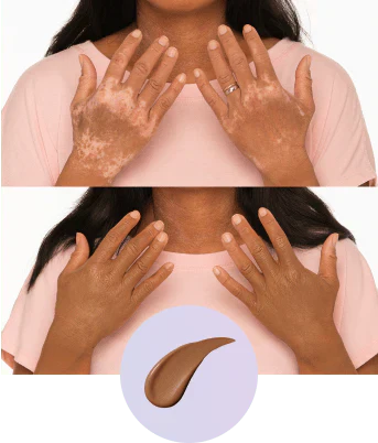 💜Last Day-Buy 1 Get 1 Free!💜✨Body Coverage Perfector – Waterproof, Lightweight & Flawless Body Makeup - Image 31