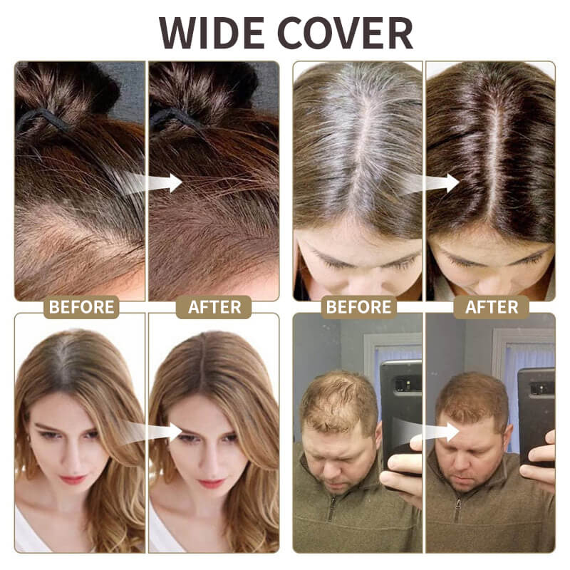 💞Buy 1 Get 1 Free💞Upgrade Magic Root Cover Up 2 - Image 9