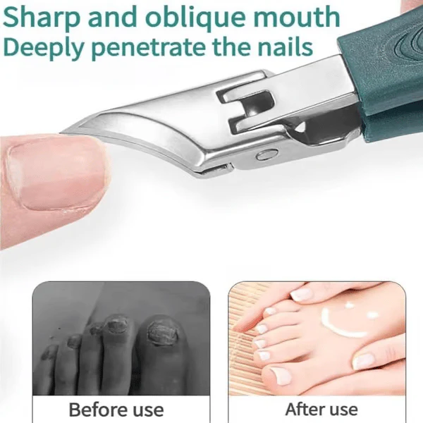 🔥Last Day Sale 49% OFF🔥Eagle Beak Angled Nail Clippers 3-Piece Set
