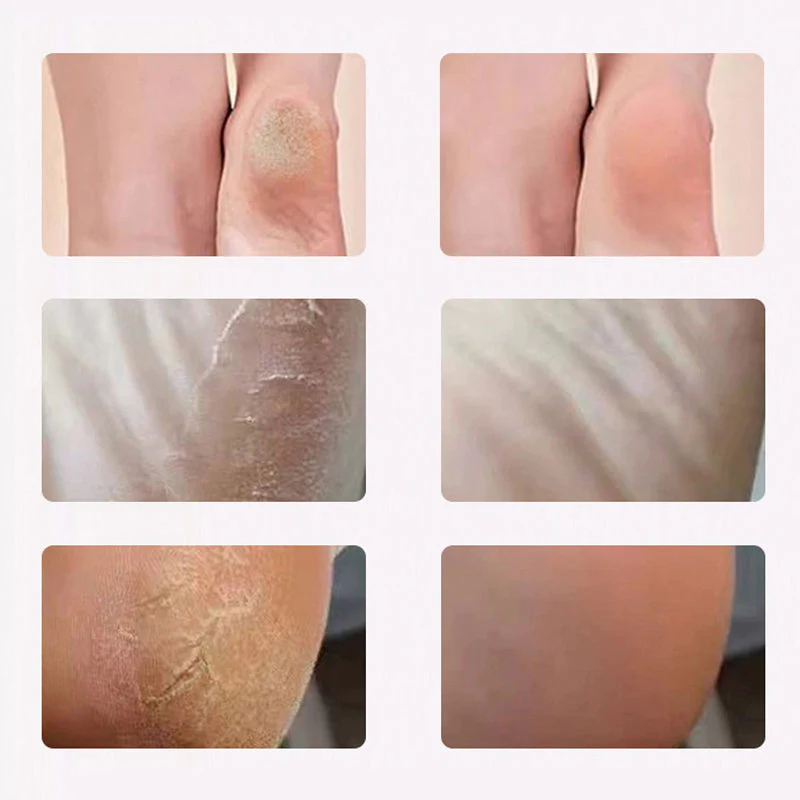 ⏳Time-limited Special🦶Electric Foot Scrubber for Smooth Healthy Skin - Image 3