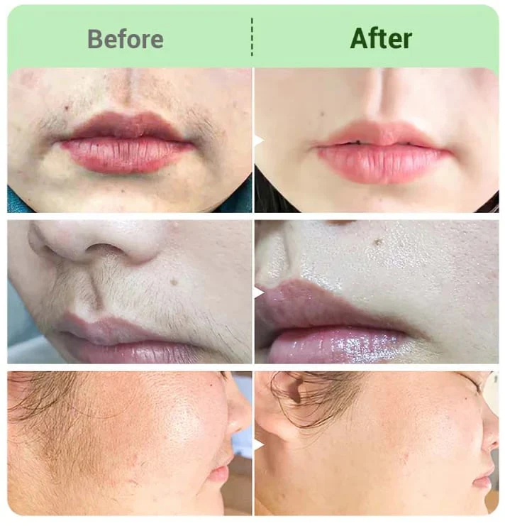 ⏰LAST DAY BUY 1 GET 1 FREE🤩Hair Removal Cream Kit for Women - Image 6