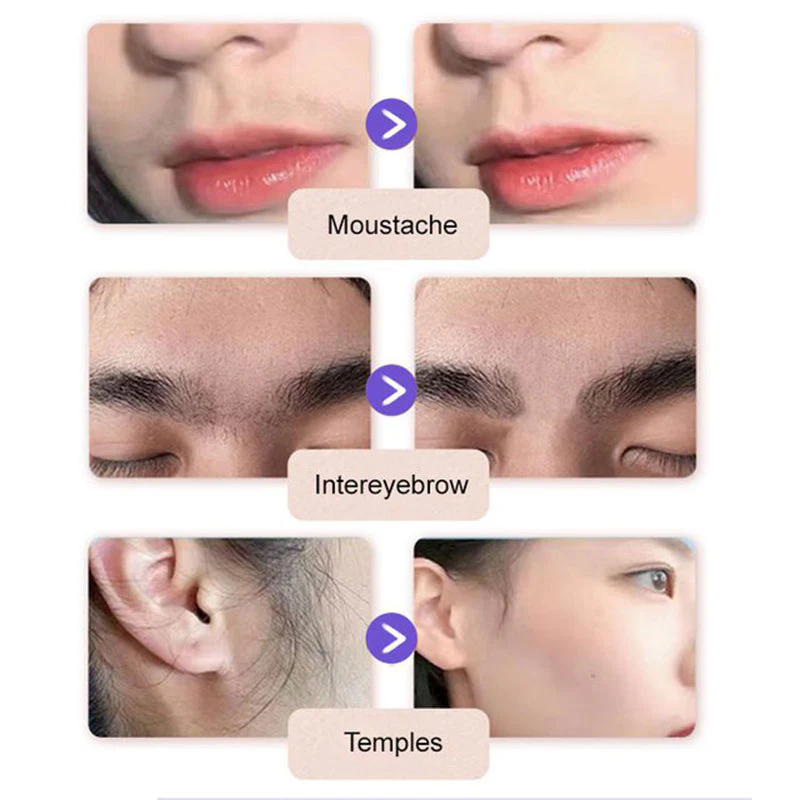 🔥Buy 2 Get 1 Free🔥Gentle and Painless Facial Hair Removal Cream - Image 6