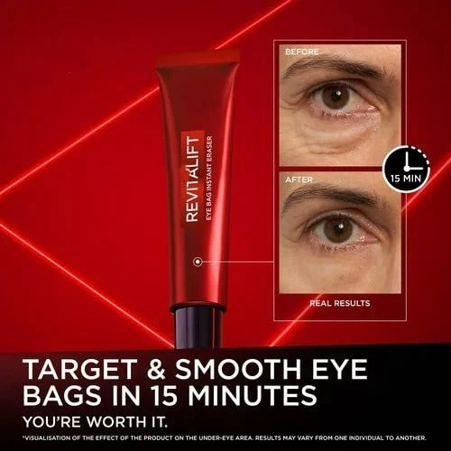🔥Last Day 49% OFF💥Eye Bag Instant Eraser, Tightens, Firms, & Blurs Wrinkles - Image 10