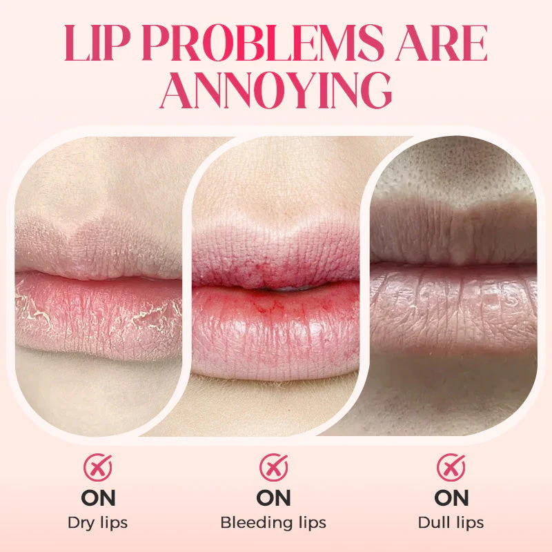 ⏳LAST DAY SALE 50% OFF!!⚡50K+ SOLD!✨Nooni Apple Hydrating Moisturizer Plump Transfer-proof Glossy Lip Stain Oil💋 - Image 2