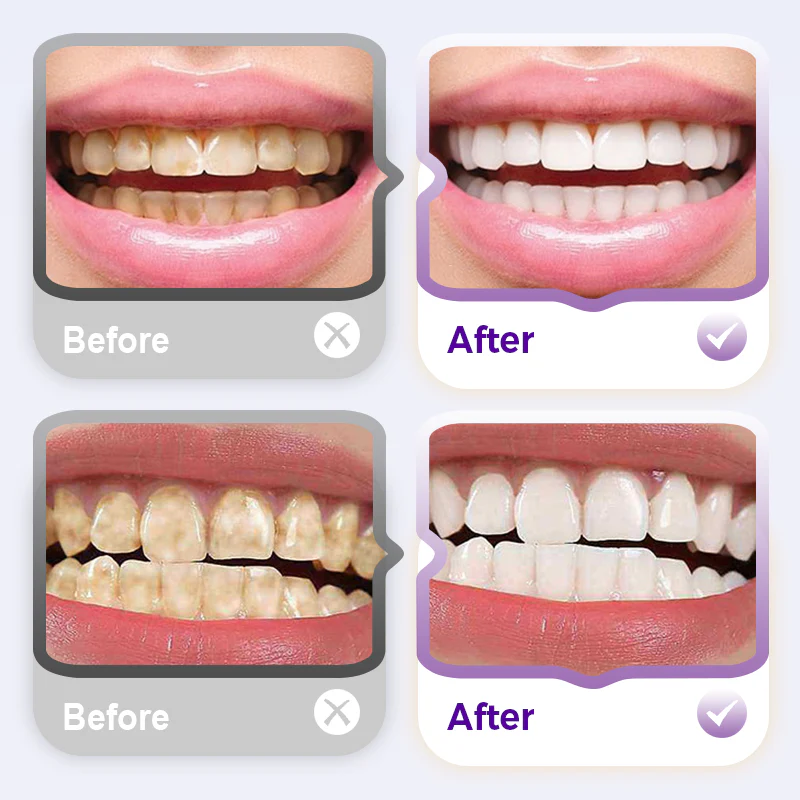 ⏳LAST DAY SALE BUY 1 GET 1 FREE!!🔥New 7-Pro Intensive Toothpaste | Upgraded Purple Formula with 7 Probiotics | Deep Enamel Repair & Long-Lasting Freshness - Image 2
