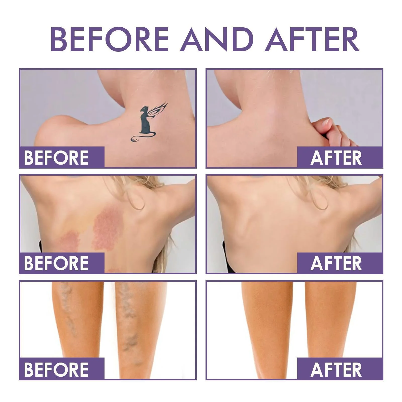 💜Last Day-Buy 1 Get 1 Free!💜✨Body Coverage Perfector – Waterproof, Lightweight & Flawless Body Makeup - Image 5
