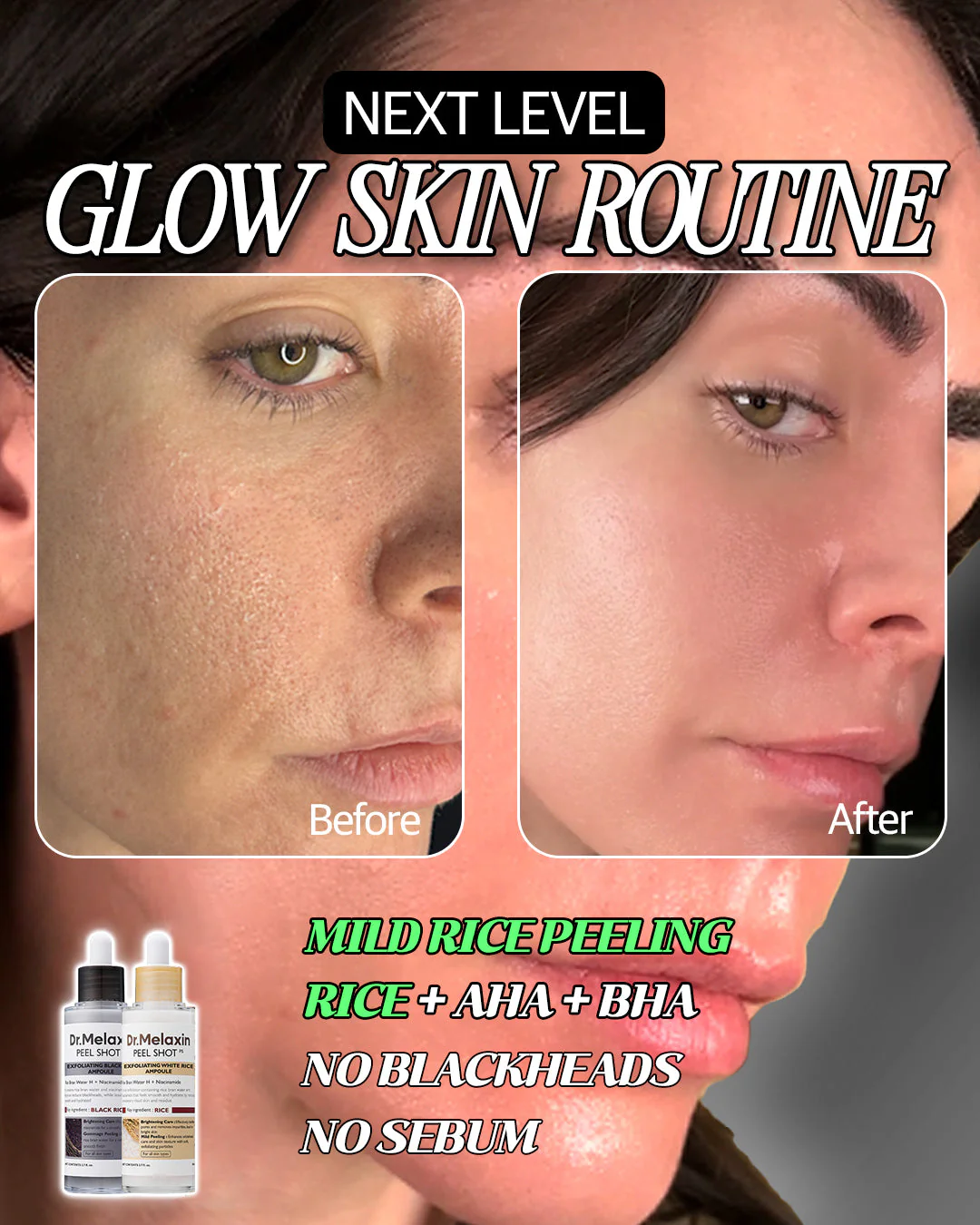 🏆LAST DAY SALE: ￡6.99!!🔥[Dr.Melaxin Official] Peel Shot Glow Rice Ampoule Duo - Serums for Brightening, Exfoliating, and Moisturizing - Suitable for All Skin Types - Image 2