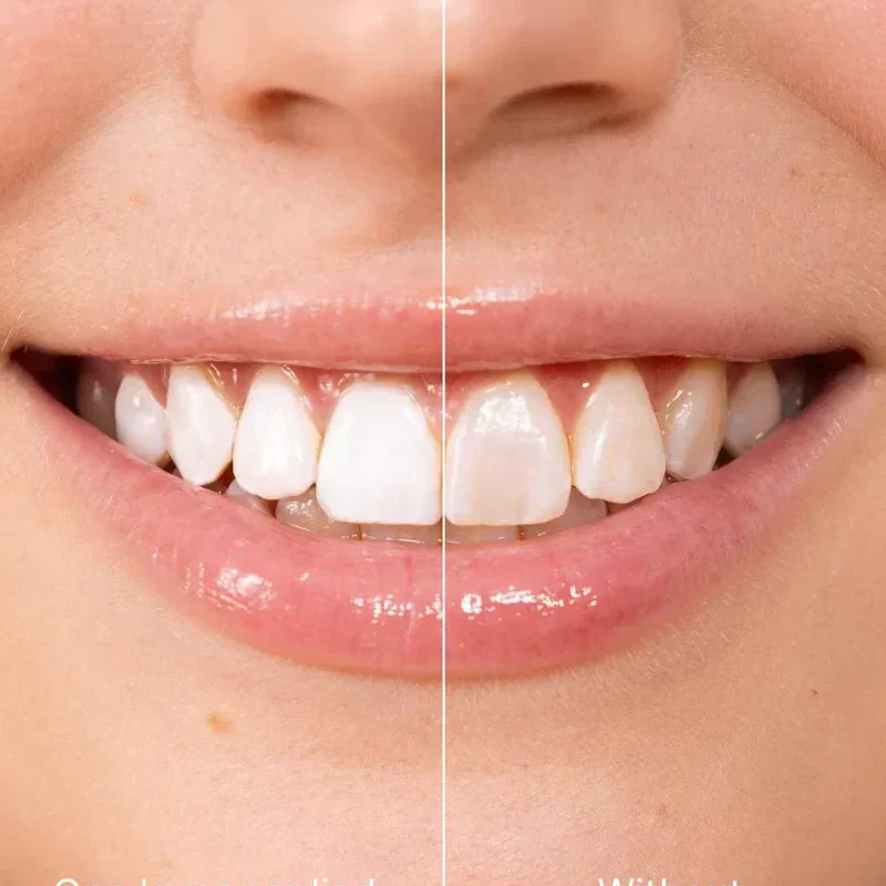 📢📢 BUY 1 GET 1 FREE!!⚡50K+ SOLD!💝Instant Whitening Tooth Paint - Image 2
